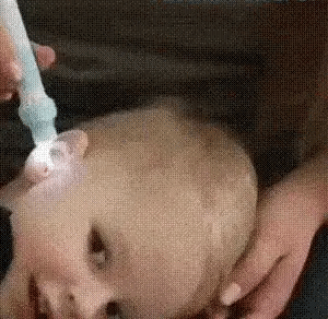 Aspirator-pentru-urechi-KIDSROSS